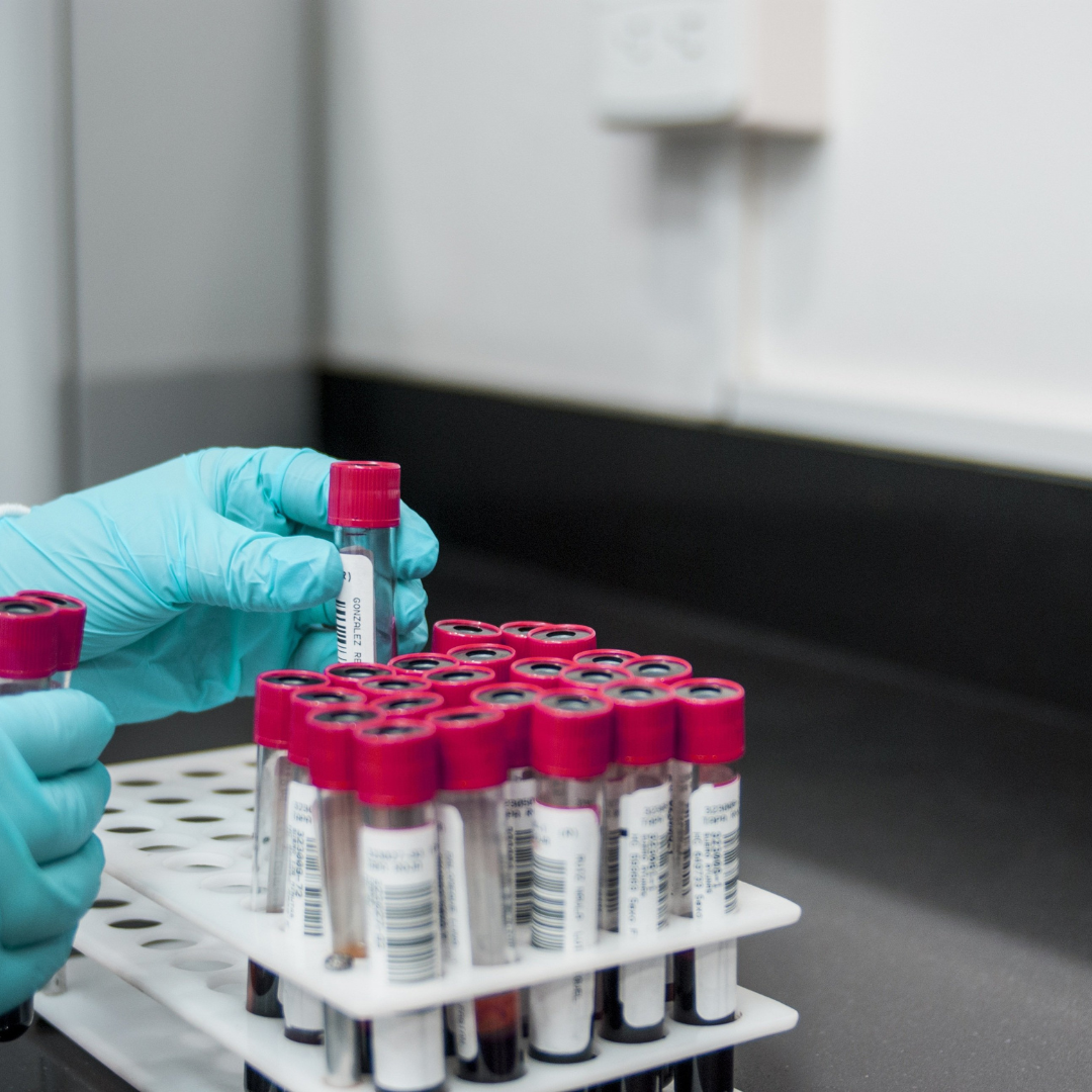 Tested for Multiple Myeloma